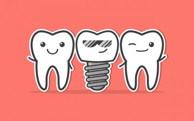 Koji zubni implantat odabrati?