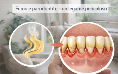 Fumo e parodontite: un pericolo silenzioso per la salute delle gengive